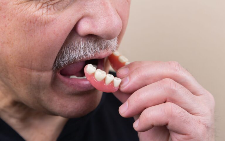 Ästhetischer und funktionaler Zahnersatz - Zahnarztpraxis Dr. Moritz Weber