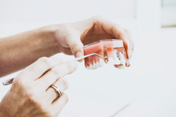 Implantologie - Zahnarztpraxis Dr. Moritz Weber